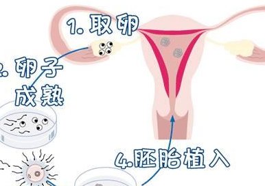 国内试管收费详情：佛山2026三代试管婴儿要花多少钱？